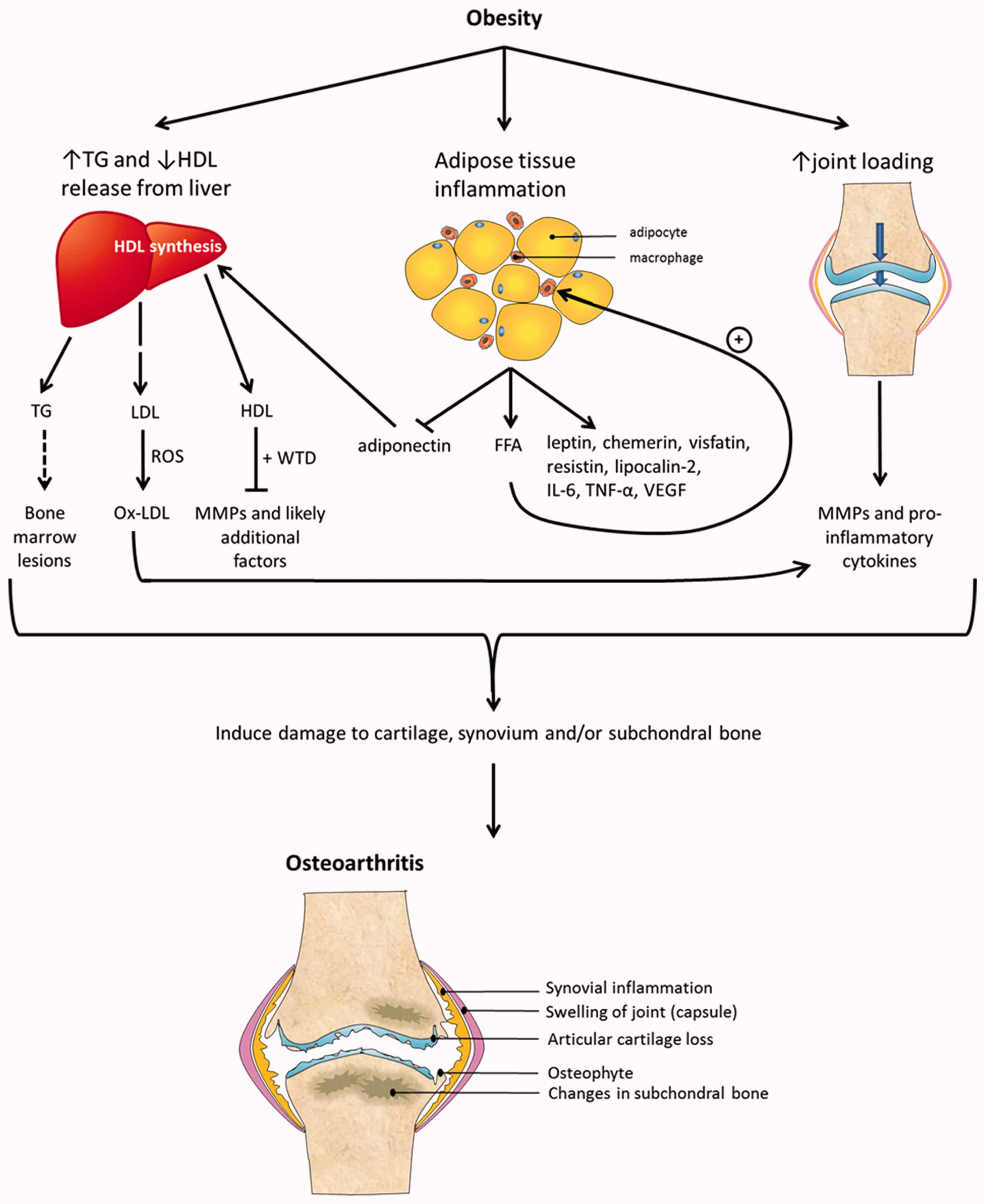 OA Obesity Adipocytes