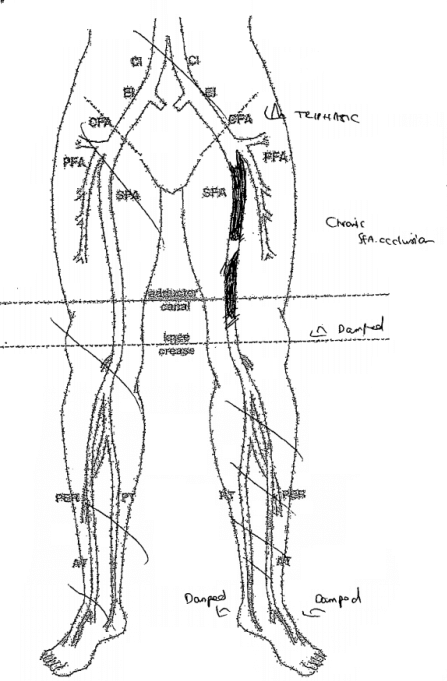 Vascular Lower Limb